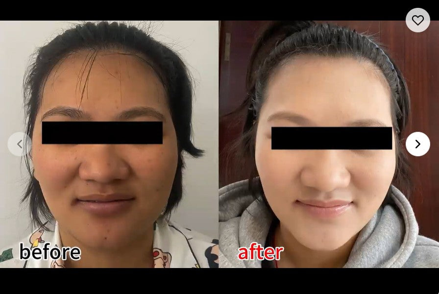 Household Rechargeable 4 Colors Soft Silicone Skincare Mask Skin Rejuvenation Anti-acne Anti-aging Face Mask